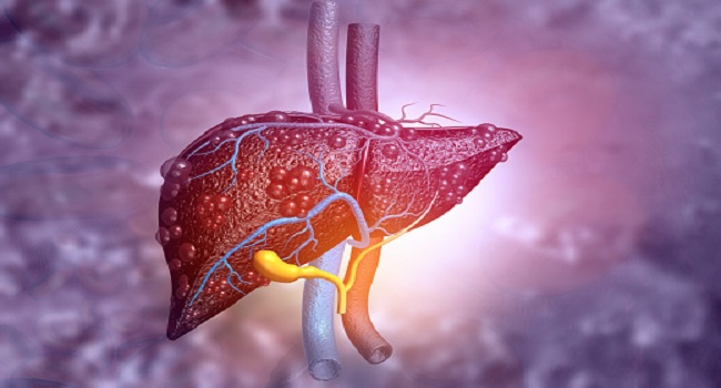 Clinical trial shows that LOLA is an effective treatment for hepatic encephalopathy