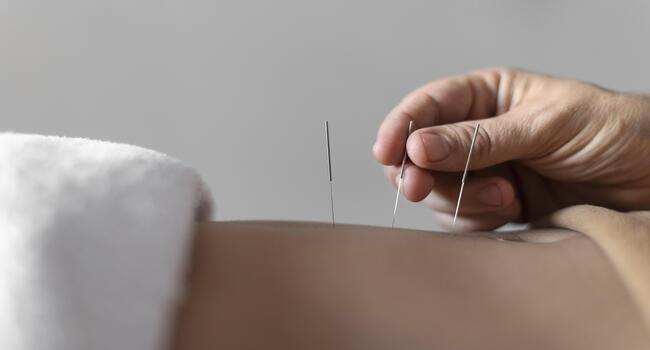 Clinical trial shows acupuncture alleviates anxiety in Parkinson's patients