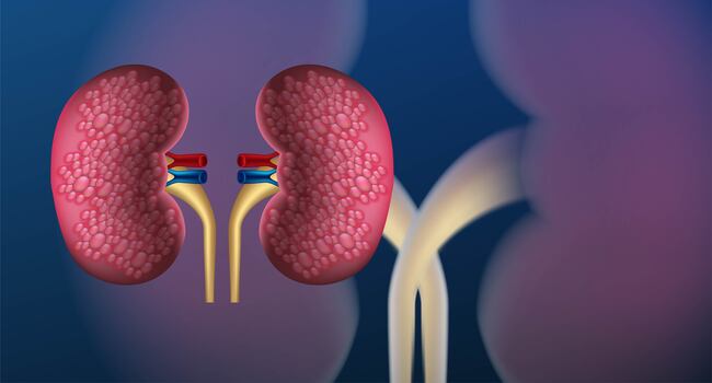 Clinical trial concludes that a diabetes medication is beneficial in preserving kidney function