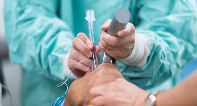 Clinical trial shows intravenous infusion is superior to gargling in treating post-surgery sore throat