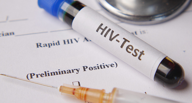 Clinical trial shows triple antibody treatment effective against HIV-1