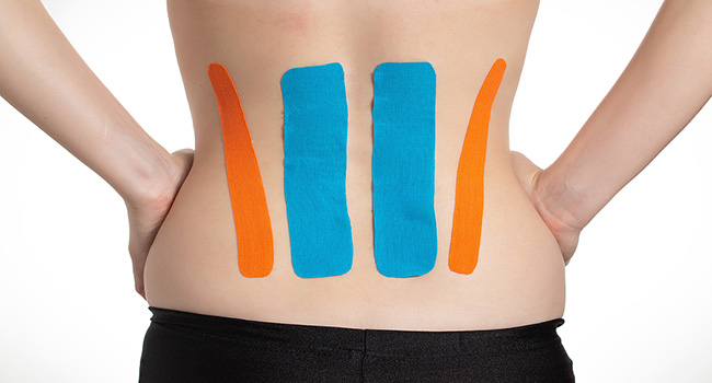 Clinical trial shows kinesio taping plus physical therapy beneficial for back pain
