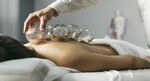 Ear Acupuncture and Cupping Therapy: An Effective Alternative for Chronic Back Pain