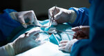 Clinical Research discovers way to Reduce Infections after Colorectal Surgery