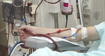 Implantable Kidney may Replace Dialysis