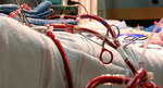 Extracorporeal Life Support may aid Severe COVID-19 Patients
