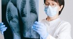 Immunosuppression improves Lung Function in Patients with RA-associated ILD