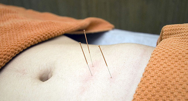 Acupuncture for Indigestion